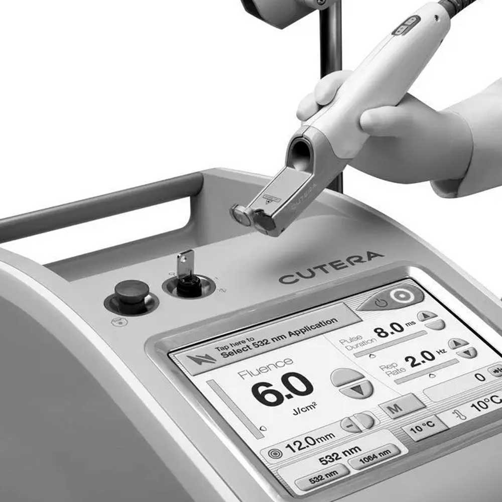 Le laser CUTERA Excel V : une technologie haut de gamme à Thionville