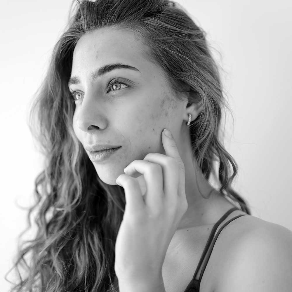 Centre Medic Esth à Thionville : votre allié contre l'acné